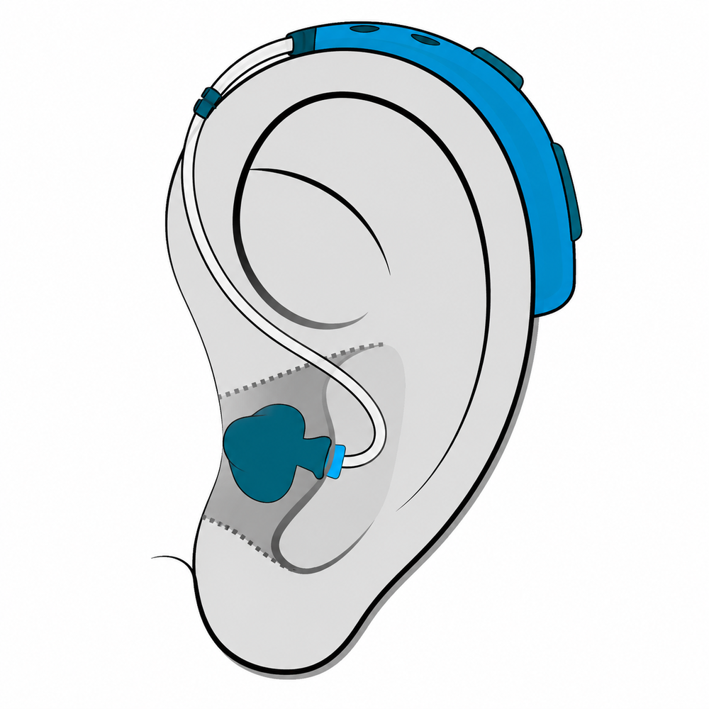 Behind-the-ear (BTE) hearing aid style fitted at The Hearing Place in Falconer, NY
