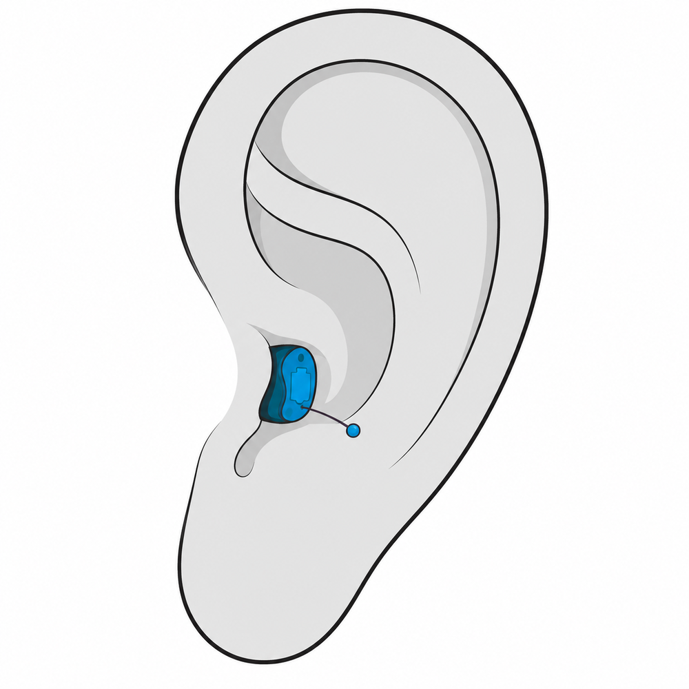 Completely-in-canal (CIC) discreet hearing aid style fitted at The Hearing Place in Falconer, NY