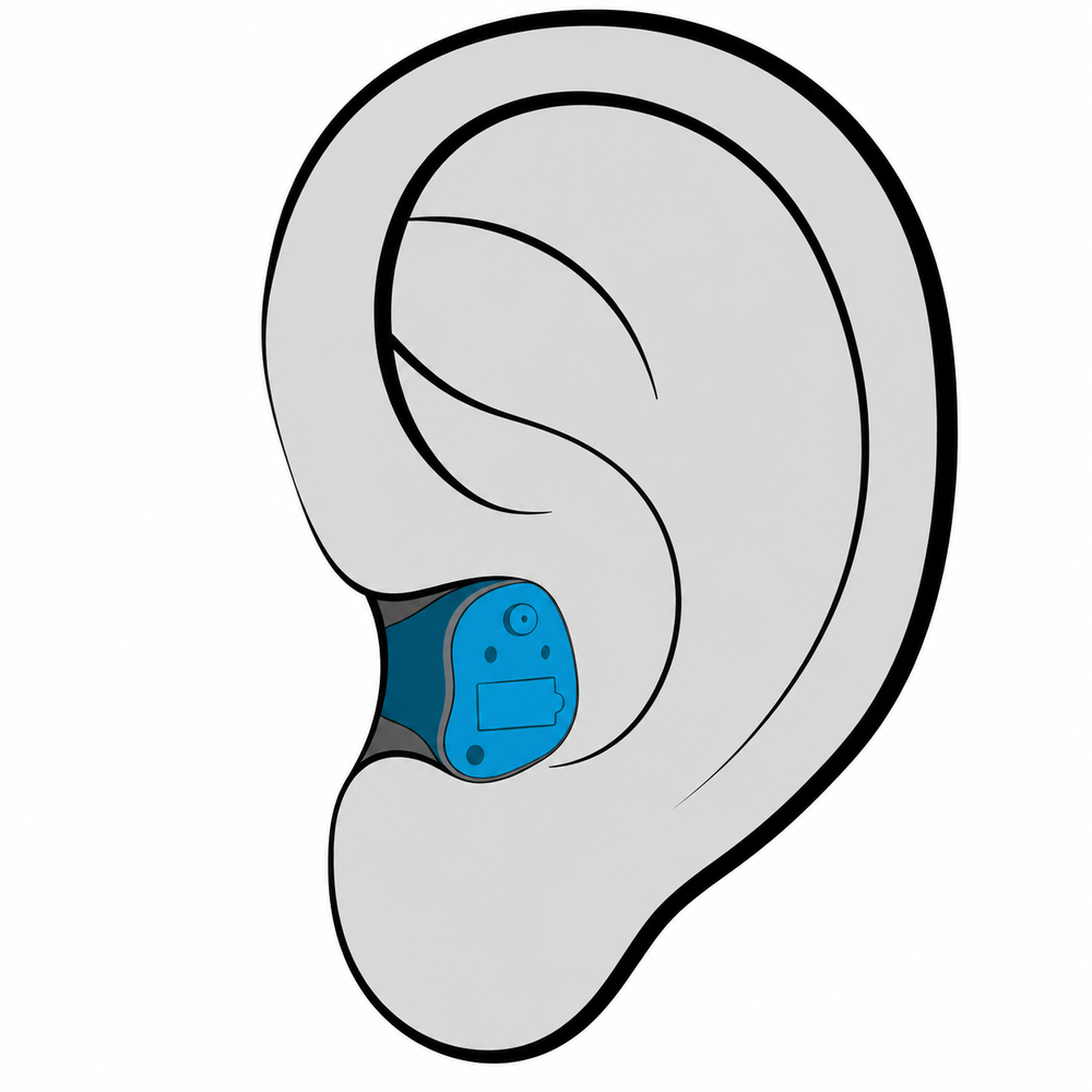 In-the-canal (ITC) custom hearing aid style fitted at The Hearing Place in Falconer, NY