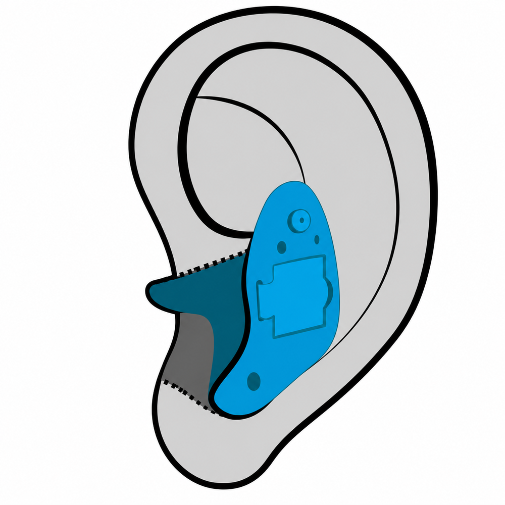 In-the-ear (ITE) custom hearing aid style fitted at The Hearing Place in Falconer, NY