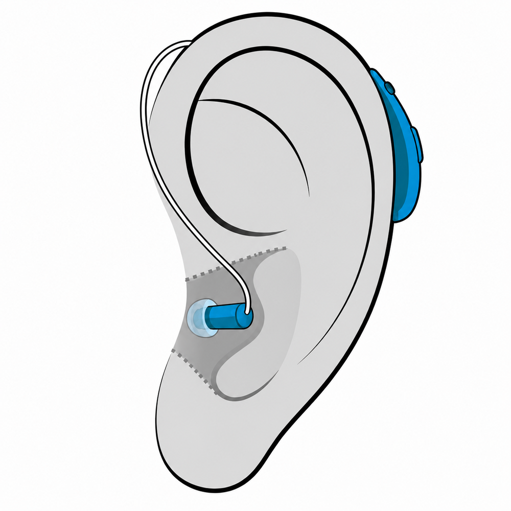 Receiver-in-canal (RIC) hearing aid style fitted at The Hearing Place in Falconer, NY